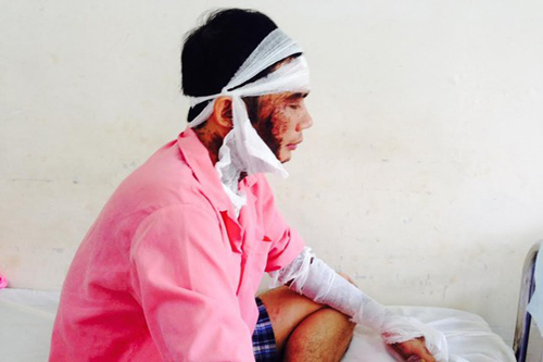 Quản lý công ty nước ngoài bị tạt a-xít dã man