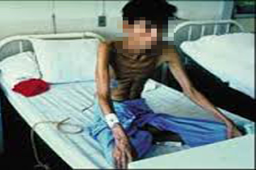 “Thoát” tù do bị AIDS, giết người xong sức khỏe lại bình thường