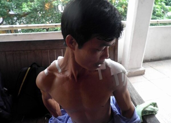 Giám đốc công ty chở côn đồ tới chém người 