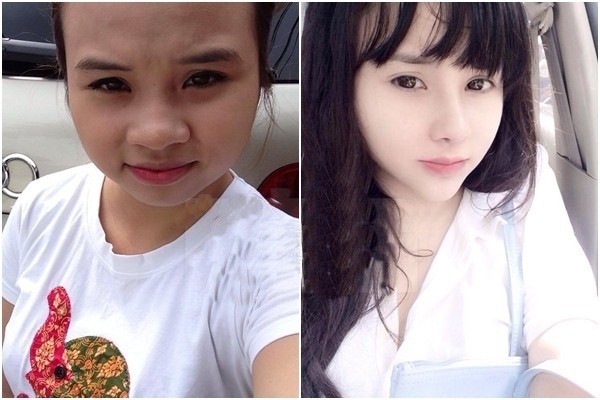 Màn lột xác kinh ngạc của cô gái HN sau phẫu thuật thẩm mỹ