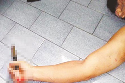 Đâm thấu lưng người tình rồi uống thuốc sâu tự tử