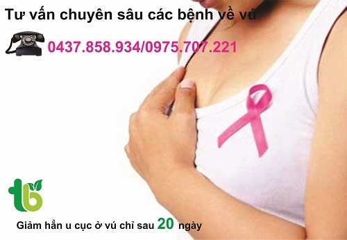 Nỗi trăn trở của phái đẹp khi bị u vú