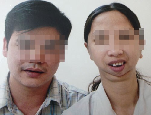 Cảm động người chồng quyết tâm cưới cô gái không há được miệng