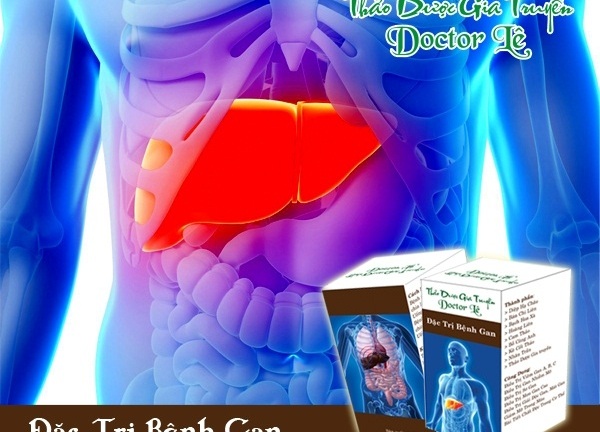 Bài thuốc quý chữa khỏi viêm gan, gan nhiễm mỡ, mỡ trong máu