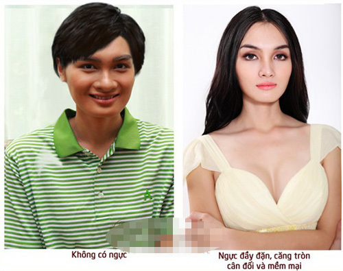 Nỗi lòng... chuyển giới: Ngực đẹp nhưng không được đụng