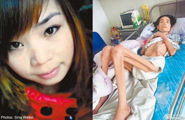 Mẹ chồng bỏ đói con dâu đến chết