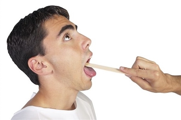 Hỏi và đáp về bệnh viêm thanh quản