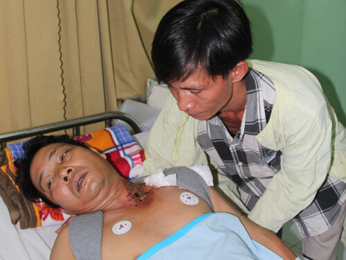 Mỏ đá nổ mìn khai thác, một người dân nhập viện