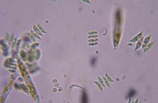Phát hiện loại virus có khả năng khiến con người trở nên ngu ngốc