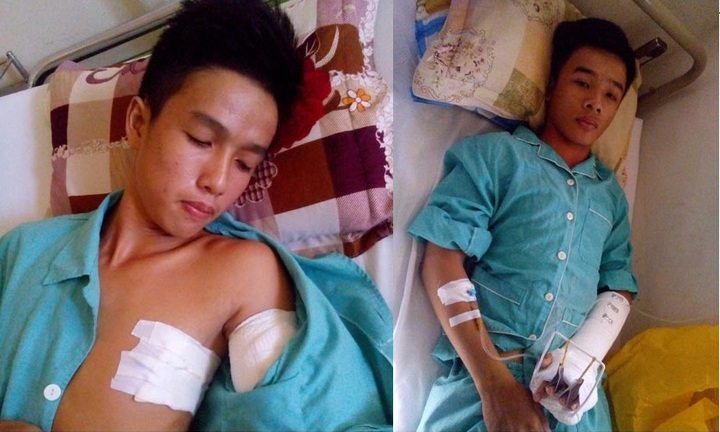 Hai nam sinh lớp 12 bị nhóm côn đồ truy sát bằng dao