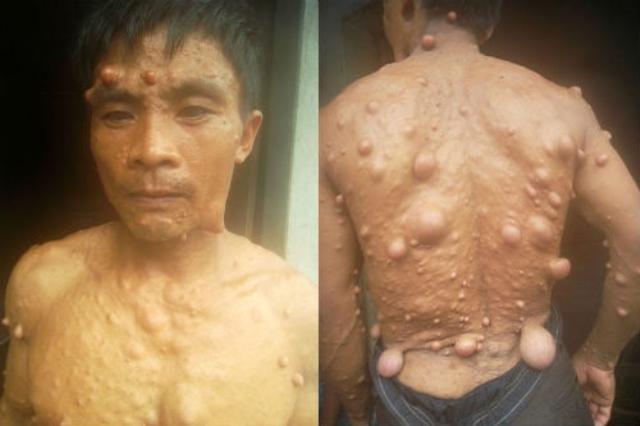 Cám cảnh cả gia đình bị bệnh tật hành hạ