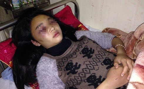 Vụ nữ sinh lớp 10 bị đánh ở Hà Tĩnh: Gia đình tiếp tục gửi đơn kiến nghị