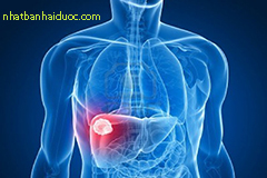 Bệnh ung thư gan và những dấu hiệu nhận biết