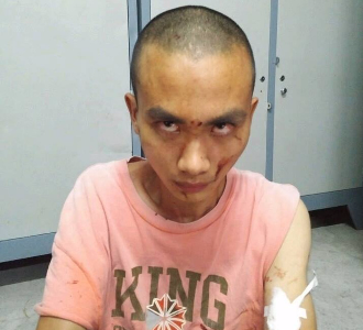 Vụ truy sát ở chùa Bửu Quang: Nghi vấn hung thủ dùng chất kích thích