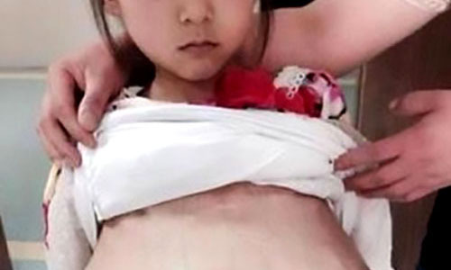 Bé 12 tuổi mang thai ở Trung Quốc từng ăn xin tại Đông Anh?