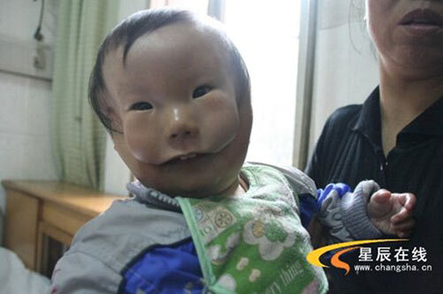 Siêu âm đều đặn, bà mẹ trẻ vẫn khóc nghẹn khi sinh con “2 mặt”