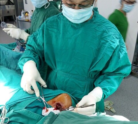 Đồng Nai: Bị cả đoạn gỗ 7cm cắm ngập vai suốt 2 tháng mà không biết