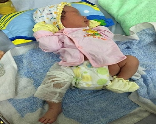Vụ làm gãy xương đùi trẻ sơ sinh: Bệnh viện nhận sai sót