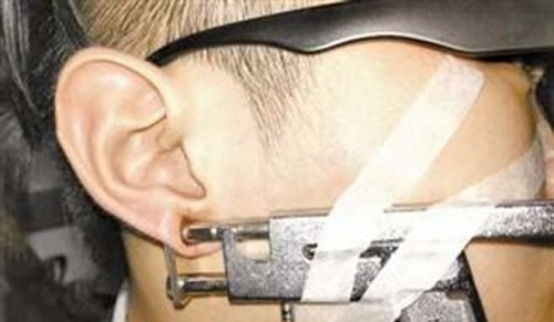 Khốn khổ vì xỏ lỗ tai