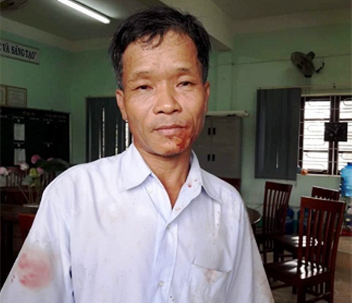 Bảo vệ trường học bị nhóm thanh niên lao vào trường hành hung