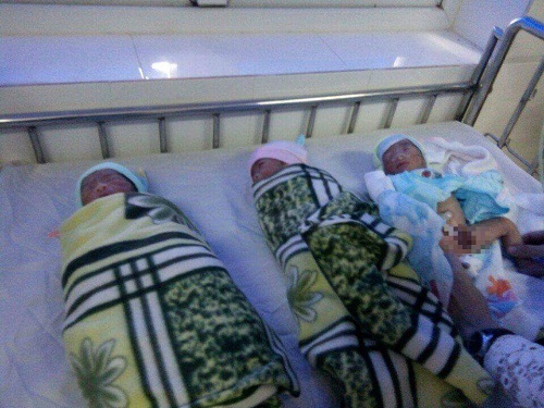 Mổ đẻ thành công cho ca sinh ba của một sản phụ vùng cao