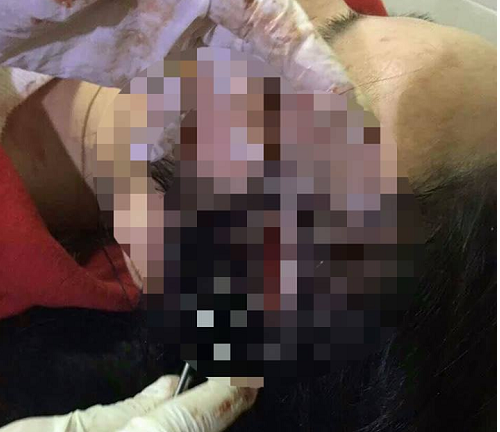 Vụ hành hung một phụ nữ: Đình chỉ công tác một cô giáo để điều tra