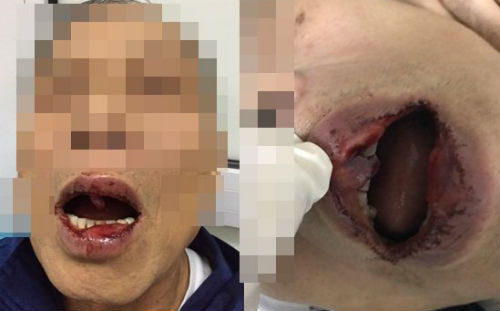 Xử lý nặng Phó giám đốc hành hung tiến sĩ 76 tuổi