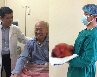 Phẫu thuật thành công khối u khổng lồ nặng 10kg cho cụ ông 84 tuổi