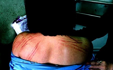 Nữ luật sư bị đương sự đánh gãy răng ngay trong phòng xử án