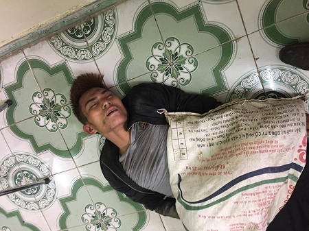 Nam thanh niên nghi trộm chó bị người dân đánh nhập viện