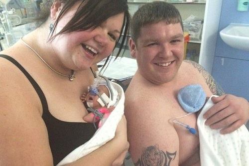 Cuộc đấu tranh vất vả giành lại sự sống của cặp song sinh sớm 3 tháng