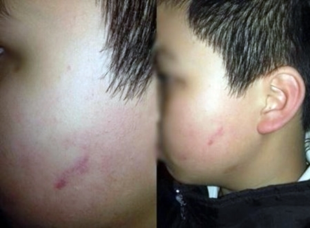 Vụ một học sinh bị 43 bạn tát mặt: Chủ tịch UBND TP Hà Nội yêu cầu làm rõ