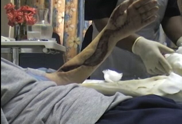 Bị rắn độc cắn vẫn dung dung chơi đùa, quay video