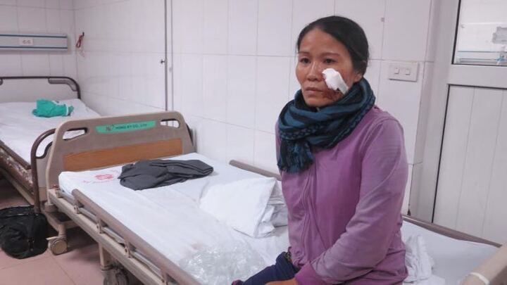 Vụ lật xe ở Nghệ An 14 người nhập viện: Hành khách kể lại giây phút sinh tử