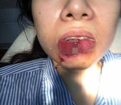 ‘Thần dược’ tràn lan, người bán tư vấn làm đẹp kiểu... ‘khép kín’!