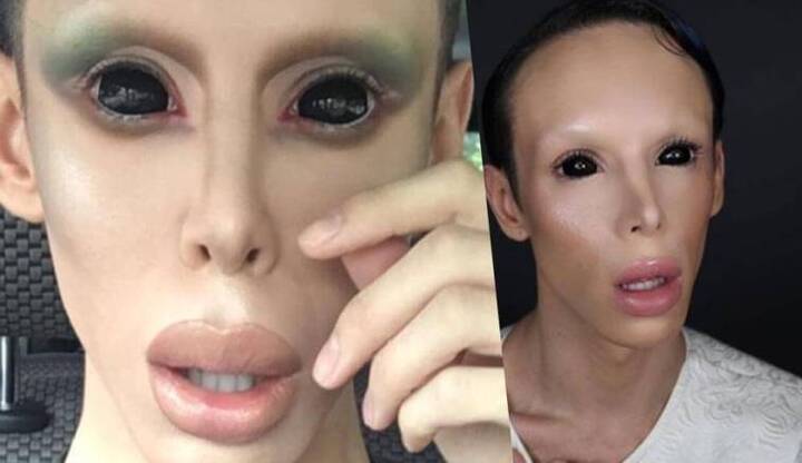 Choáng với chàng trai chi 50.000 đô la để phẫu thuật thành người ngoài hành tinh