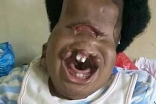 Lại thêm một đứa trẻ sinh ra giống 