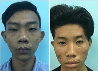 Nhóm thiếu niên kề dao uy hiếp, cướp tài sản cặp tình nhân đang tâm sự