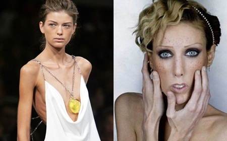 Ám ảnh số đo và những người mẫu mất mạng vì “ép xác”