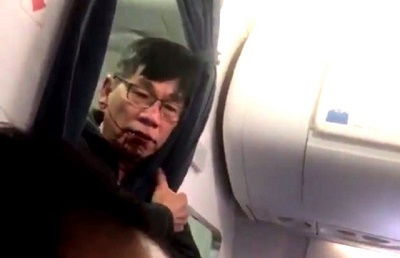 Bí mật về số tiền United Airlines bồi thường bác sỹ gốc Việt