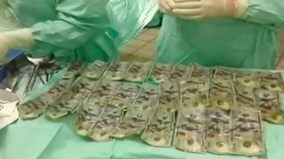 Nuốt 160 triệu tiền mặt vì cãi nhau với chồng