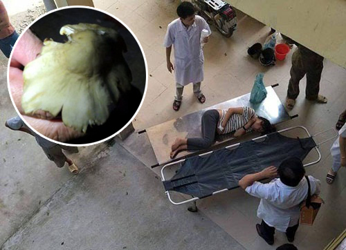 Ăn nấm lạ, 6 người phải nhập viện do ngộ độc