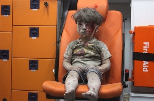 Bất ngờ với hình ảnh của cậu bé Syria mình bê bết máu chấn động thế giới sau 1 năm