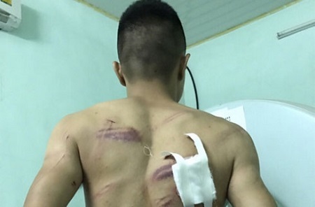 Bắt tạm giam 7 đối tượng dùng hung khí truy sát người giữa ban ngày