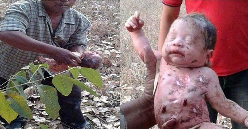 Bé trai sơ sinh bị đâm 14 nhát dao rồi chôn sống ở Thái Lan và câu chuyện hồi sinh kỳ lạ