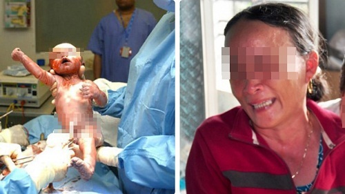 Quyết định bất ngờ của mẹ chồng khi con dâu trở dạ nguy kịch