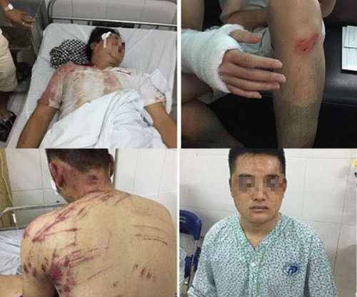 Hà Nội: Điều tra vụ nhóm thanh niên vác hung khí đánh trọng thương 4 người 