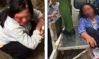 Đốt xe, đánh người vì nghi bắt cóc trẻ em: Đừng nhân danh lẽ phải!