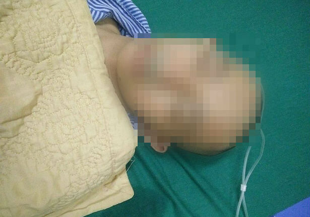 Nam sinh lớp 10 bị bạn đánh trọng thương ngay trong lớp học