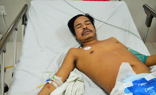 Hy hữu: Người đàn ông sống sót 6 ngày trong rừng sau khi bị rắn cực độc cắn